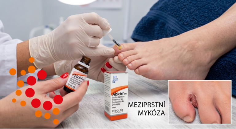 Jak na plíseň nohou a nehtů? Poznejte první příznaky a objevtě sílu fytoterapie s Abicinem